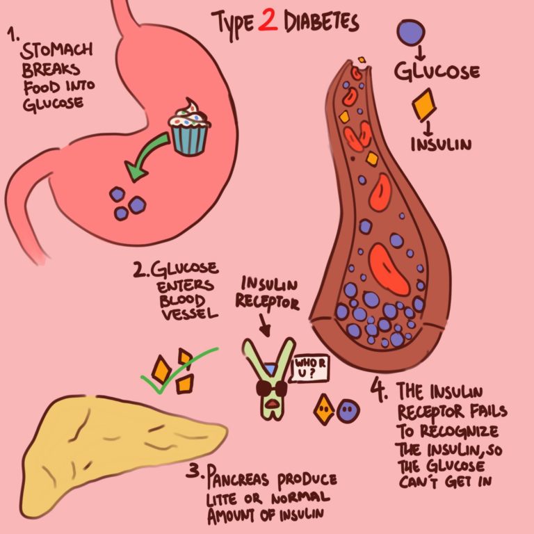 Diabetes
